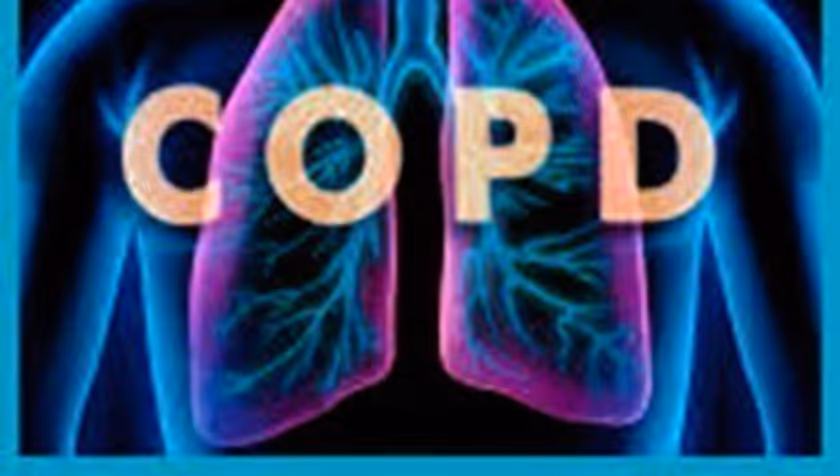 New RE-SAMPLE publication: a pan-European service model for supporting self-management of people with COPD and comorbidities